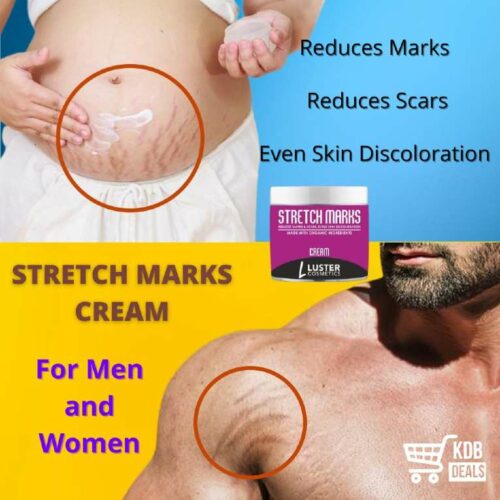 Luster Cosmetics Stretch Marks Cream (Reduces Marks & Scars) -100g
