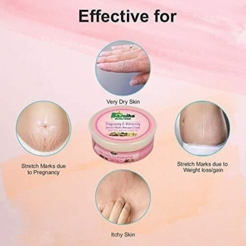 Basaika Herbal Care Pregnancy Maternity Stretch Marks Removal Cream1