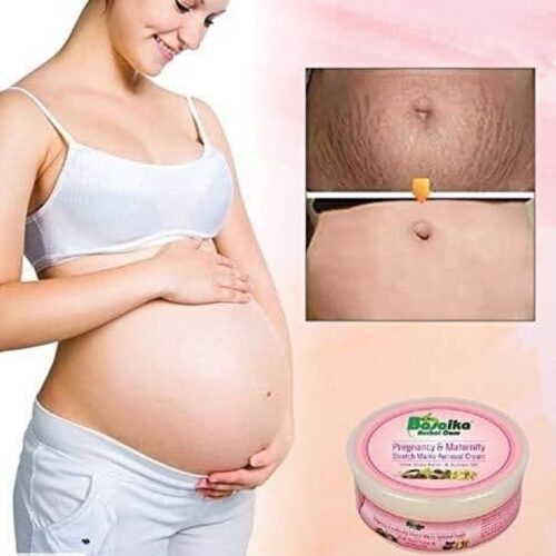 Basaika Herbal Care Pregnancy & Maternity Stretch Marks Removal Cream