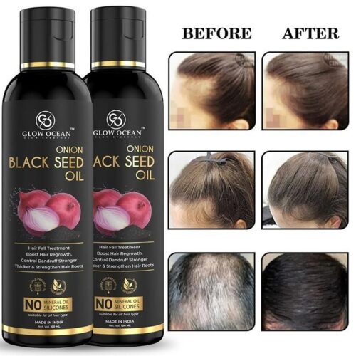 Ocean Onion Blackseed oil For Hair Fall Control,Hair Growth & Hair Regrowth-Control Dandruff (200Ml)