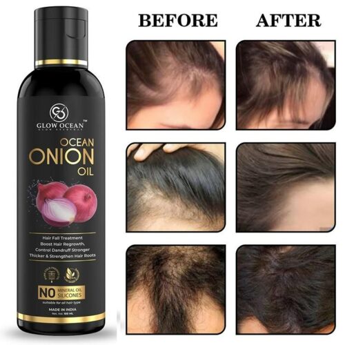 Ocean Onion oil For Hair Fall Control,Hair Growth & Hair Regrowth-Control Dandruff (100Ml)