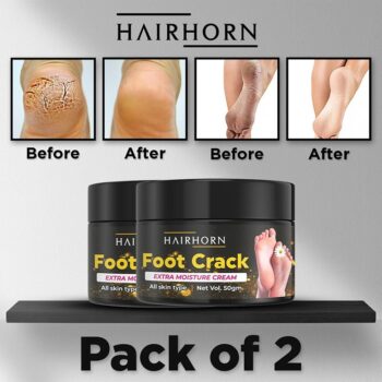 HAIRHORN Crack Cream For Dry Cracked Heels & Feet 50gm (Pack of 2)