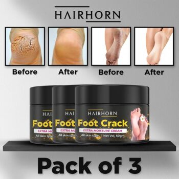 HAIRHORN Crack Cream For Dry Cracked Heels & Feet 50gm (Pack of 3)