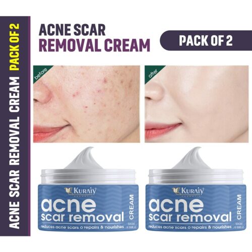 KURAIY Acne Face Cream Herbal Pimple Scar Removal Shrink Pore Oil Control Moisturizing Facial Cream Acne Pack of 2