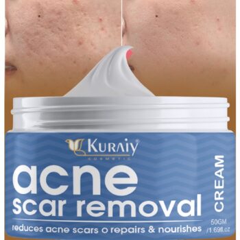 KURAIY Acne Face Cream Herbal Pimple Scar Removal Shrink Pore Oil Control Moisturizing Facial Cream Acne Treatment Skin Care