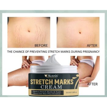 KURAIY Effective Remove Pregnancy Scars Acne Cream Stretch Mark Treatment Maternity Repair Anti-Aging Anti-Winkle Firming Body Cream