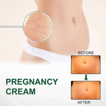 KURAIY Remove Pregnancy Scars Acne Cream Stretch Marks Treatment Maternity Repair Anti-Aging Anti-Winkles Firming Body Creams