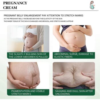 KURAIY Remove Pregnancy Scars Acne Cream Stretch Marks Treatment Maternity Repair Anti-Aging Anti-Winkles Firming Body Creams