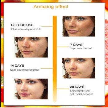 Kuraiy Best Vitamin C Brightening Skin Face Serum, Fades Dark Spots & Hyper Pigmentation, Experience Glowing Skin, Dermatologically Tested, For Men & Women, All Skin (30 ml)