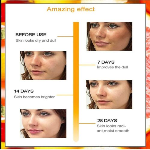 Kuraiy Best Vitamin C Brightening Skin Face Serum, Fades Dark Spots & Hyper Pigmentation, Experience Glowing Skin, Dermatologically Tested, For Men & Women, All Skin (30 ml)