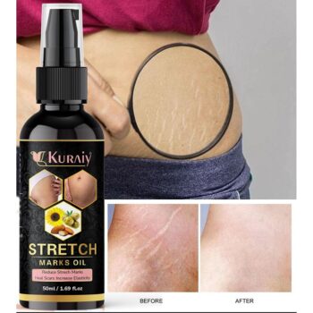 Kuraiy stretch Oil for Stretch Marks Removal Post Pregnancy fast work result stretch mark cream oil (50 ml)