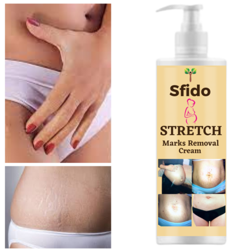 Sfido Stretch Marks Removal Cream for Pregnancy with Goodness of Shea Butter Cream, 100gm