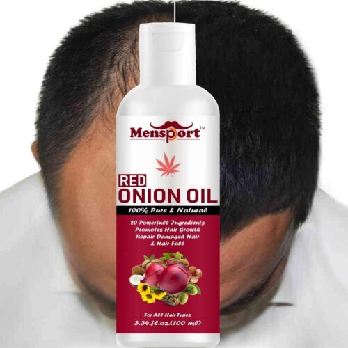 200 red onion oil enriched with 20 powerfull ingredients to original imafsnpbzvgdntgb