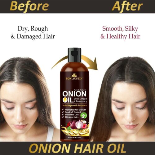 300 premium onion herbal oil for hair anti hair fall enriched original