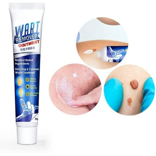 Warts Remover Ointment 1