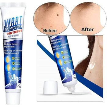 Herbal Extract Warts Remover Ointment