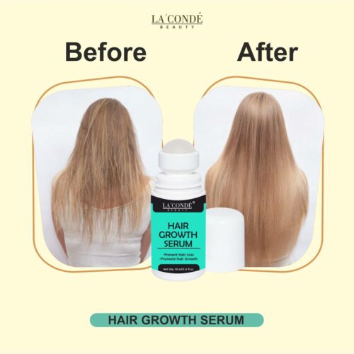 roll on hair growth serum reduce hair fall pack of 1 of 50 ml la original imagjpy2tgu2yg9g 1